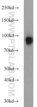 CD39/ENTPD1 Antibody in Western Blot (WB)