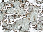 CD39/ENTPD1 Antibody in Immunohistochemistry (Paraffin) (IHC (P))