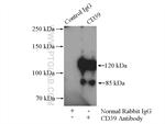 CD39/ENTPD1 Antibody in Immunoprecipitation (IP)