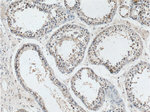 ATN1 Antibody in Immunohistochemistry (Paraffin) (IHC (P))