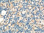 ATN1 Antibody in Immunohistochemistry (Paraffin) (IHC (P))