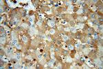 KIF18A Antibody in Immunohistochemistry (Paraffin) (IHC (P))