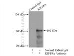 KIF18A Antibody in Immunoprecipitation (IP)