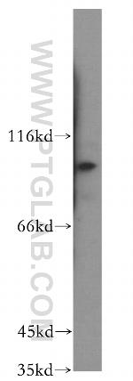 KIF18A Antibody in Western Blot (WB)