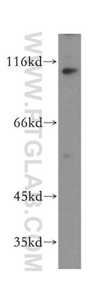 KIF18A Antibody in Western Blot (WB)