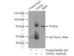 TNFR2 Antibody in Immunoprecipitation (IP)