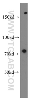 TNFR2 Antibody in Western Blot (WB)