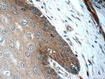 CLCA2 Antibody in Immunohistochemistry (Paraffin) (IHC (P))