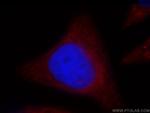 OAS2 Antibody in Immunocytochemistry (ICC/IF)