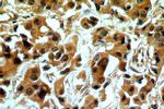 OAS2 Antibody in Immunohistochemistry (Paraffin) (IHC (P))