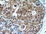 OAS2 Antibody in Immunohistochemistry (Paraffin) (IHC (P))