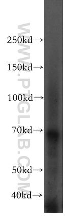 OAS2 Antibody in Western Blot (WB)