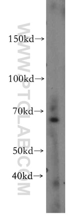 OAS2 Antibody in Western Blot (WB)