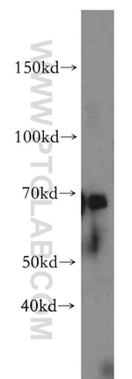 OAS2 Antibody in Western Blot (WB)