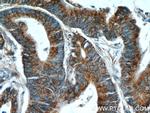 HCFC1 Antibody in Immunohistochemistry (Paraffin) (IHC (P))