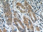 NUP85 Antibody in Immunohistochemistry (Paraffin) (IHC (P))