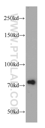 NUP85 Antibody in Western Blot (WB)