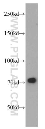 NUP85 Antibody in Western Blot (WB)