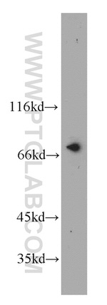 NUP85 Antibody in Western Blot (WB)