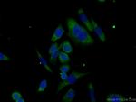 ABHD14A Antibody in Immunocytochemistry (ICC/IF)