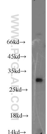 ABHD14A Antibody in Western Blot (WB)