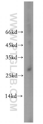 C19orf43 Antibody in Western Blot (WB)