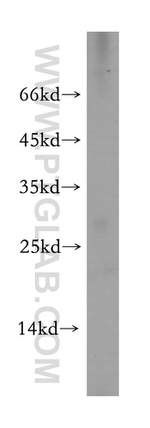 C19orf43 Antibody in Western Blot (WB)