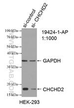 CHCHD2 Antibody in Western Blot (WB)