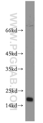 CHCHD2 Antibody in Western Blot (WB)