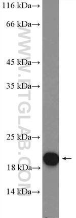 CHCHD2 Antibody in Western Blot (WB)