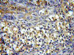 PIH1D1 Antibody in Immunohistochemistry (Paraffin) (IHC (P))