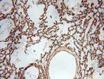 PIH1D1 Antibody in Immunohistochemistry (Paraffin) (IHC (P))