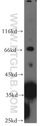 PIH1D1 Antibody in Western Blot (WB)