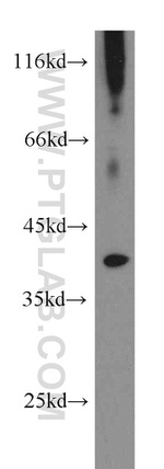 PIH1D1 Antibody in Western Blot (WB)