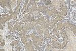 ZIP7 Antibody in Immunohistochemistry (Paraffin) (IHC (P))