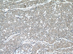 HUWE1 Antibody in Immunohistochemistry (Paraffin) (IHC (P))