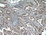 HUWE1 Antibody in Immunohistochemistry (Paraffin) (IHC (P))