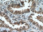 HUWE1 Antibody in Immunohistochemistry (Paraffin) (IHC (P))