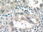 ALDH3B1 Antibody in Immunohistochemistry (Paraffin) (IHC (P))