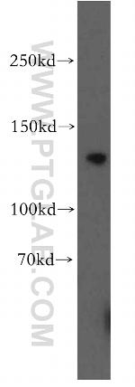 TRPC1 Antibody in Western Blot (WB)