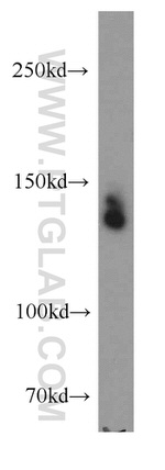 TRPC1 Antibody in Western Blot (WB)