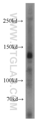 TRPC1 Antibody in Western Blot (WB)