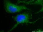 Nestin Antibody in Immunocytochemistry (ICC/IF)