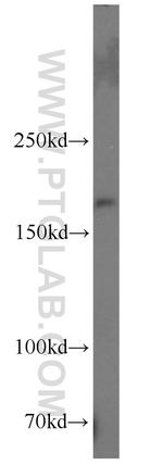 Nestin Antibody in Western Blot (WB)