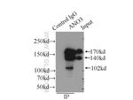 ANO3 Antibody in Immunoprecipitation (IP)