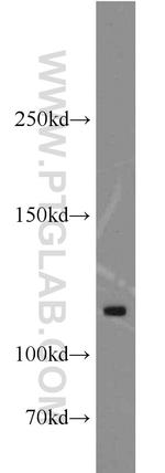 ANO3 Antibody in Western Blot (WB)