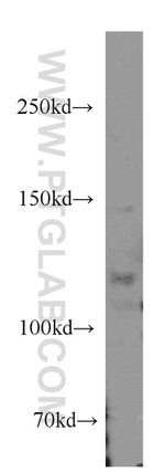 ANO3 Antibody in Western Blot (WB)