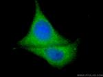 ATG14/Barkor (N-terminal) Antibody in Immunocytochemistry (ICC/IF)