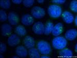 ATG14/Barkor (N-terminal) Antibody in Immunocytochemistry (ICC/IF)