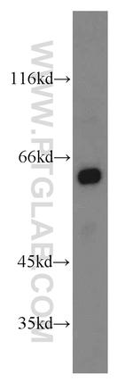 ATG14/Barkor (N-terminal) Antibody in Western Blot (WB)